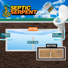 Septic Serpent™ Tank Treatment Fast-Acting Eco-Friendly Liquid Septic Tank Treatment Breaks Down Waste with High-Potency Enzymes & Beneficial Bacteria, All-Natural Protection for Septic Tanks