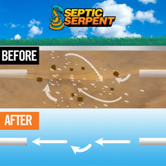 Septic Serpent™ Tank Treatment Fast-Acting Eco-Friendly Liquid Septic Tank Treatment Breaks Down Waste with High-Potency Enzymes & Beneficial Bacteria, All-Natural Protection for Septic Tanks